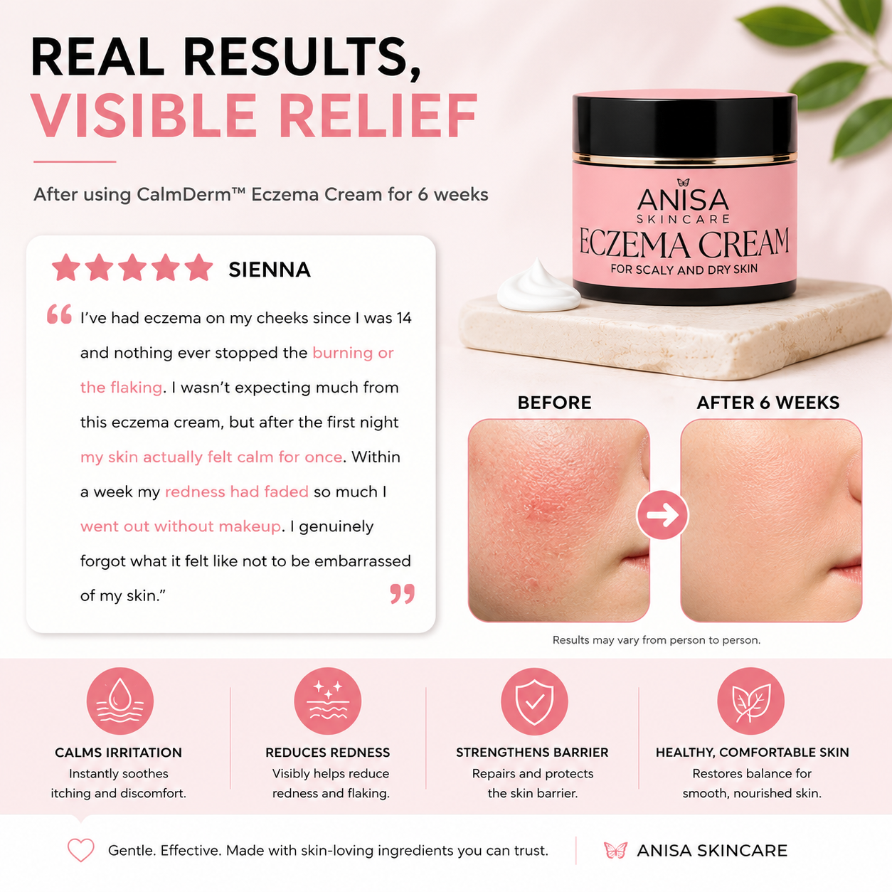 CalmDerm™ Eczema Cream