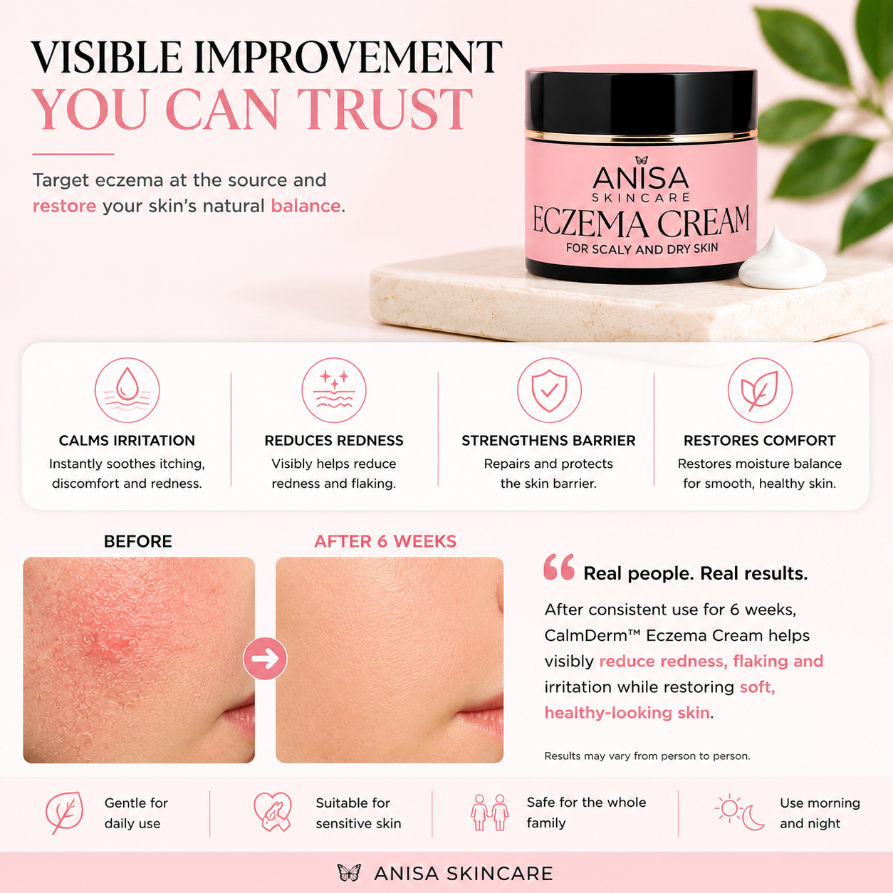 CalmDerm™ Eczema Cream