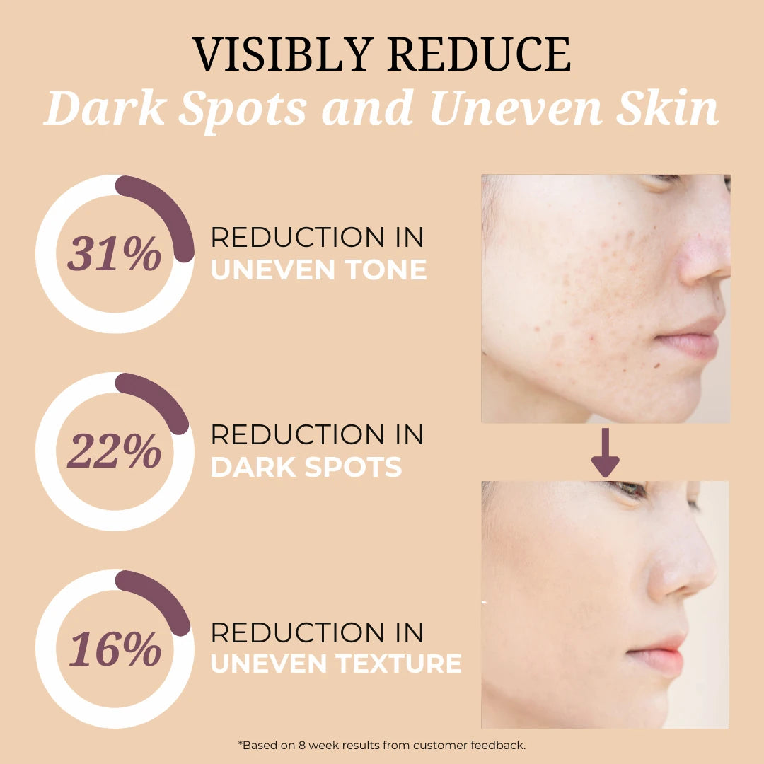 Dark Spot Cream