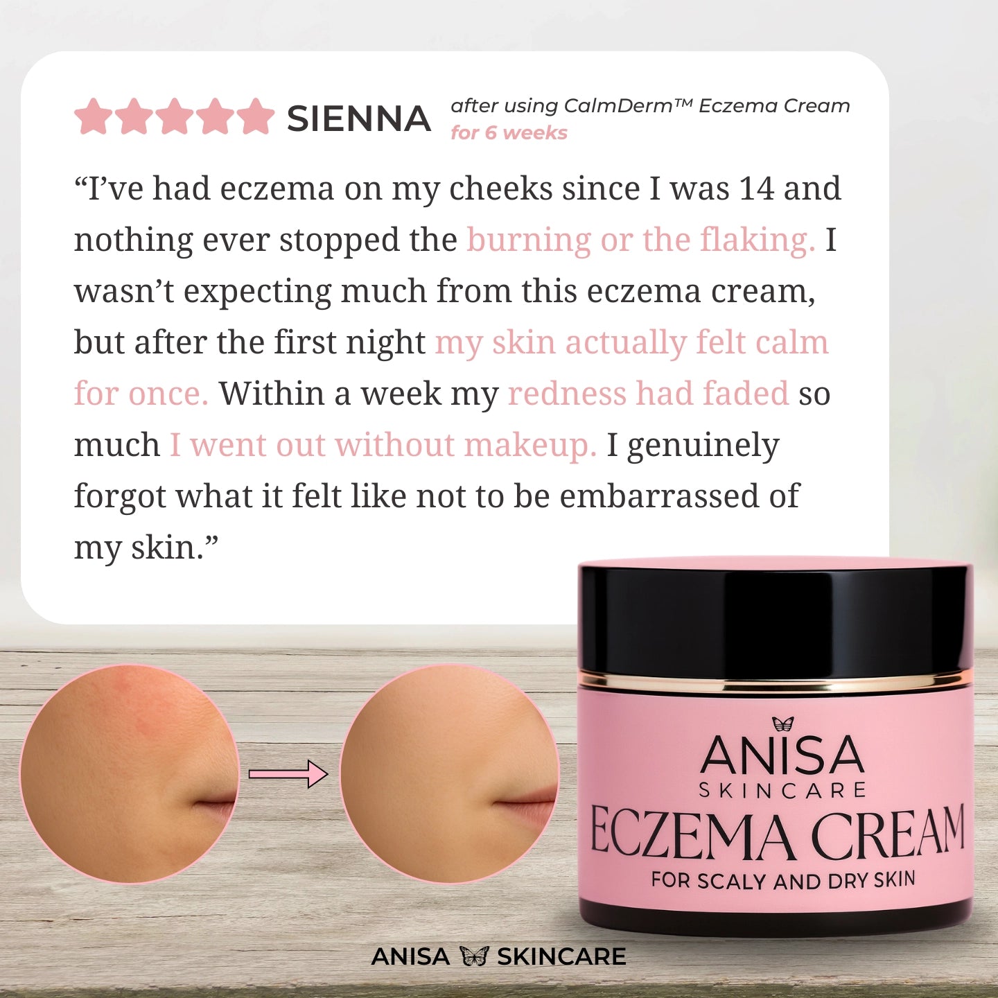 CalmDerm™ Eczema Cream