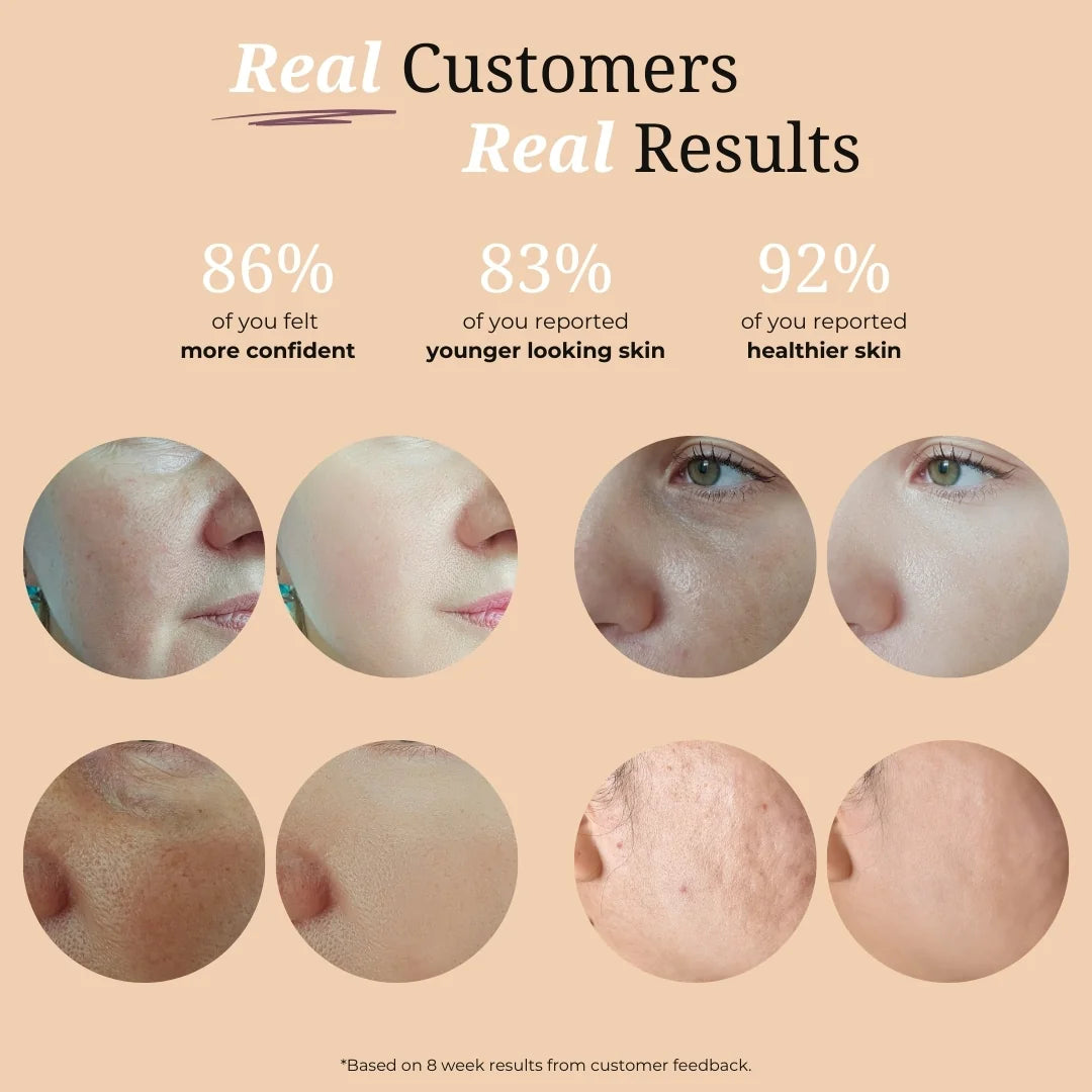 Botox-Like Peptide Serum